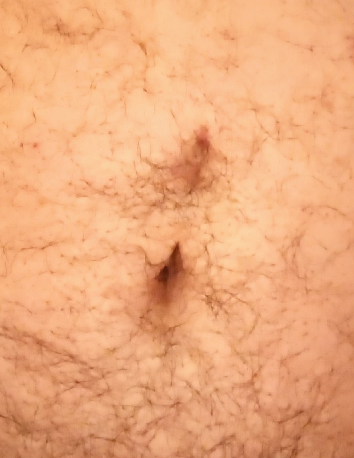ombligos